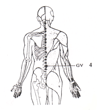 acuponcture  colonne 