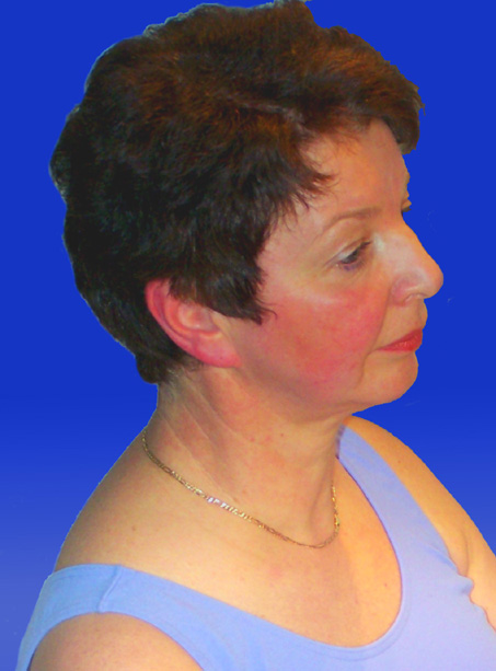 Suzanne